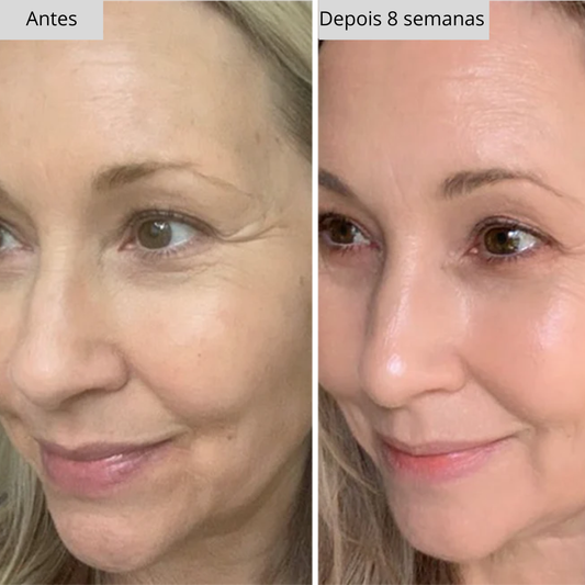 Máscara de LED Cure